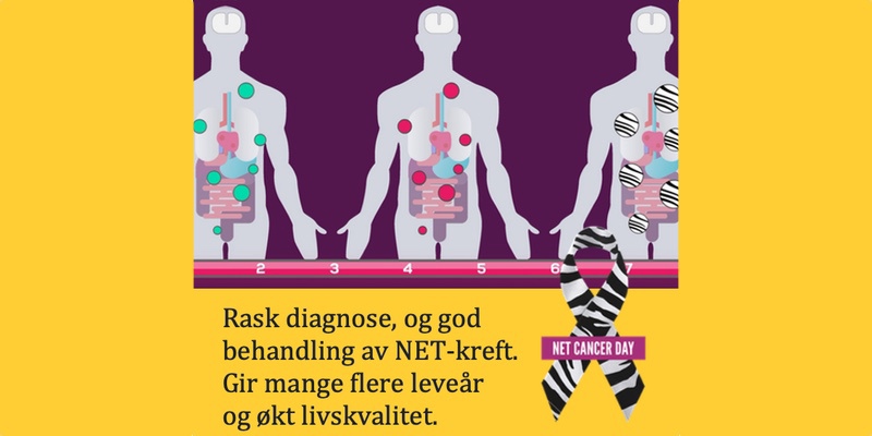 Stor forskningsstudie på NET-kreft pasienter