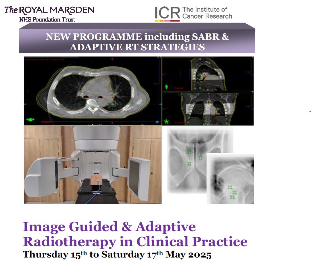 Royal Marsden: Image Guided and Adaptive Radio